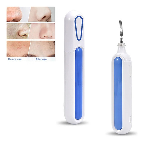 Espátula Limpiadora De Poros Portátil For Piel, Exfoliante