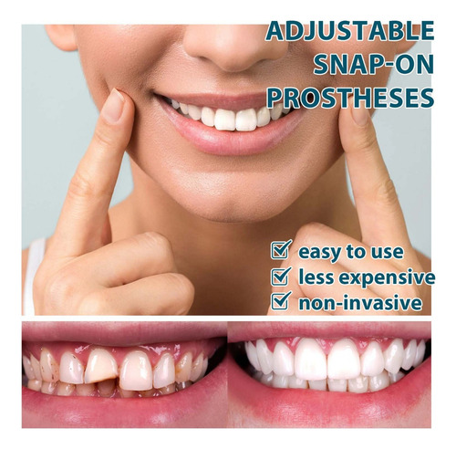 Wu Soportes Ajustables For Dentaduras Temporales Rellenos
