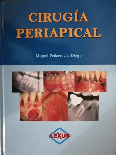 Odontologia Cirugía Periapical Un Tomo  Lexus 