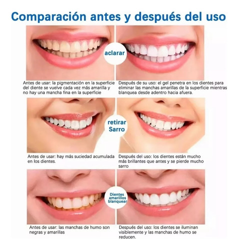5 Cajas Con 14 Pares C/u De Teeth Whitening
