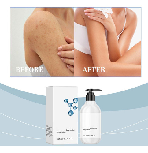 La Loción Corporal C Proporciona Nutrición, Sequedad, Opacid