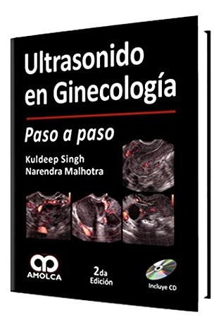 Libro Ultrasonido En Ginecología De Kuldeep Singh Narendra M
