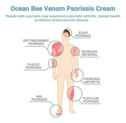 1pc Crema Curativa Para Psoriasis Piguay Bee & Ocean