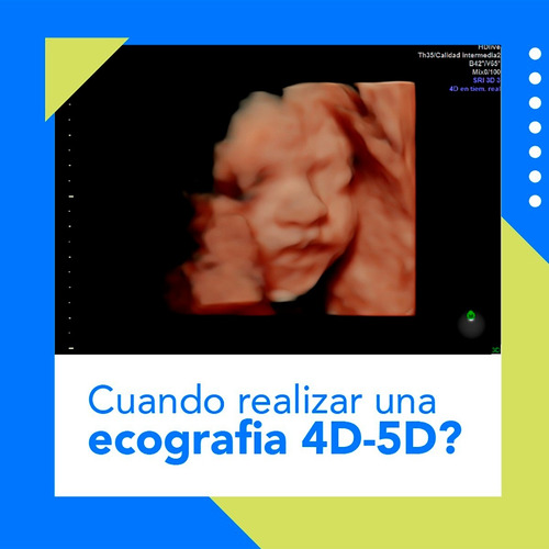 Ecografía Y Ecodoppler Vascular A Domicilio Grales - 5d 4d