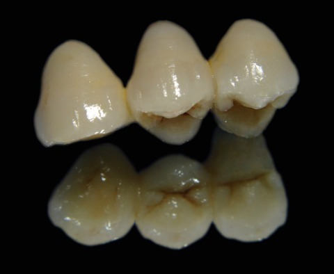 Imagen 4 de 5 de Dentista-odontólogo/limpieza De Sarro