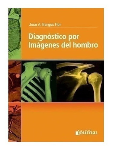 Diagnóstico Por Imágenes Del Hombro - Burgos Flor, José A.