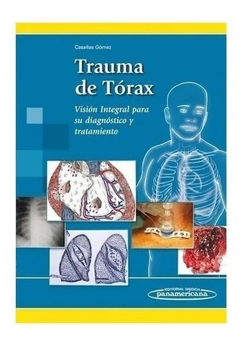 Trauma De Torax Vision Integ Para Su Diagnostico Tto Nuevo!