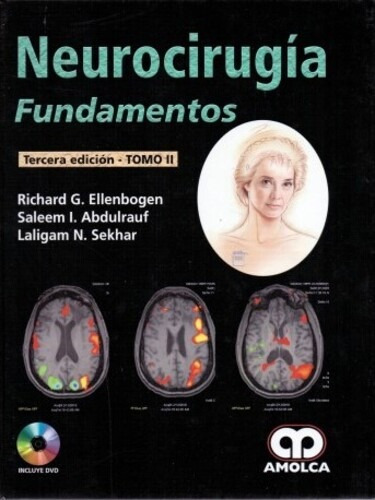 Neurocirugía  Fundamentos - Ellenbogen, Richard G. (papel)