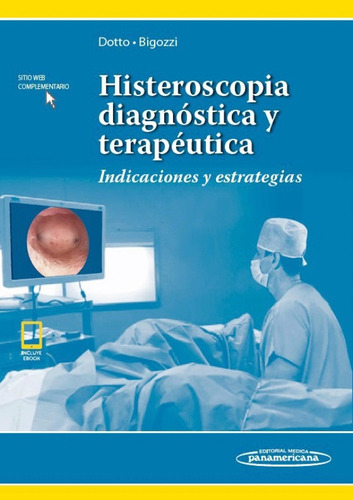 Dotto Histeroscopia Diagnóstica Y Terapéutica. Indicaciones