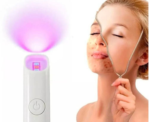 Removedor Laser Tratamiento Acne Granitos Manchas Cicatriz 