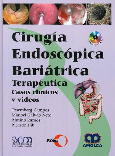 Libro Cirugía Endoscópica Bariátrica De Josemberg M Campos M