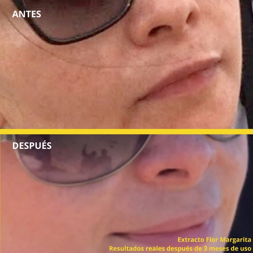 Crema Despigmentante Quita Manchas Y Paño Bridunn Skincare