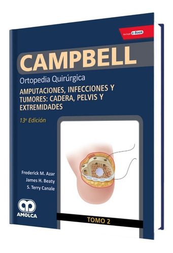 Campbell Tm 2 Amputacion Infeccion Tumores Cadera Pelvi Extr