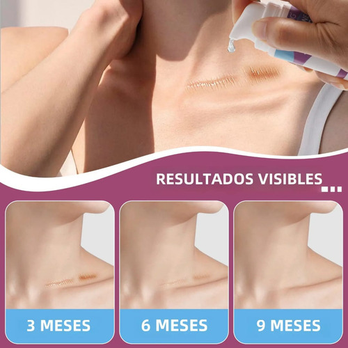 Scar Gel Vogsig Elimina Cicatrices Queloide Abdominoplastia