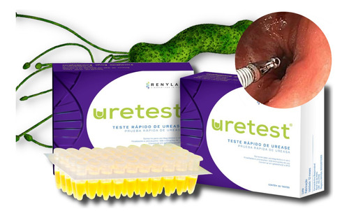 Uretest 50 Pruebas Para Detectar H. Pylori Endoscopia