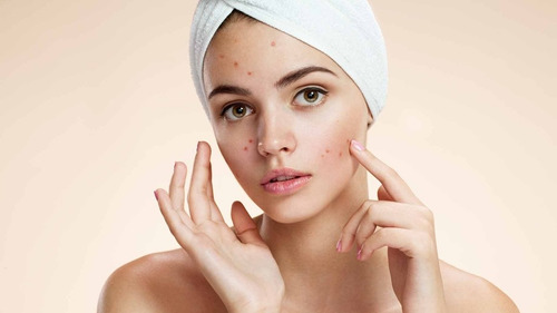 Anti Acné Crema Andrinas Y Oxy 10% Contr - g a $250