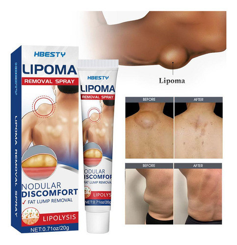 - Crema Para Eliminar Lipomas, Crema Limpiadora De Lipomas.
