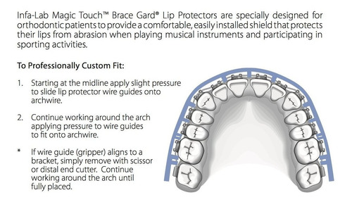 Nuestro Bestseller Protectores De Labios Ortodónticos (1 Jue