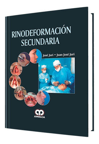 Rinodeformación Secundaria. Libro De Cirugía Plástica.