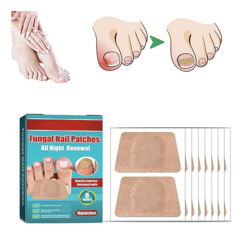 16 Parches De Uñas Para Hongos Tratamiento Onicomicosis