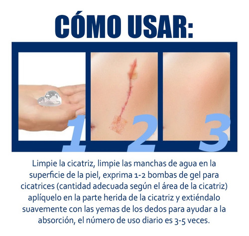 Gel De Silicona Para Eliminar Cicatrices De Cesárea Estrías Neutra