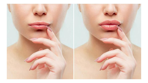 Engrosador De Labios Lip Plumping Balm C/acido Hialuronico