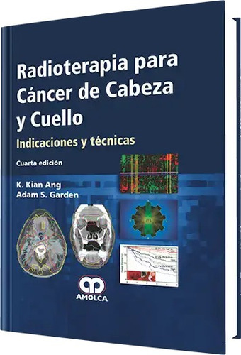 Radioterapia Para Cáncer De Cabeza Y Cuello. 4 Edición Ang