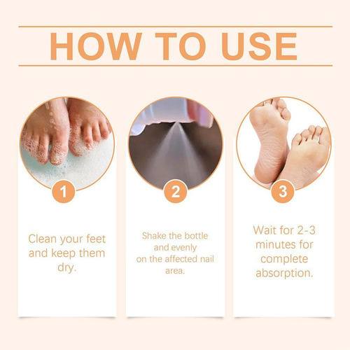 , 2 Sprays Calmantes Para Hongos En Las Uñas De 20 Ml