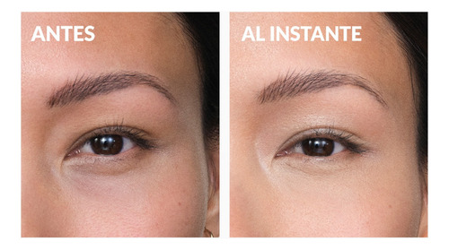 Anew Protinol Power Crema Para El Contorno De Los Ojos Tipo de piel Todo tipo de piel