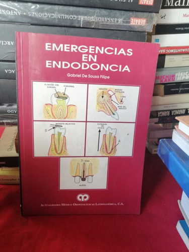 Emergencia En Endodoncia Gabriel De Sousa