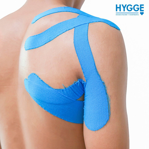 Imagen 7 de 10 de Cinta Tapping Vendaje Neuromuscular Kinesiología 5cm X 5mts