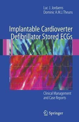 Libro Implantable Cardioverter Defibrillator Stored Ecgs ...