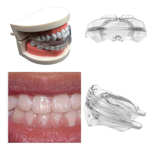 Corrector Dental Ortodoncia Adultos Enderezar Herramienta