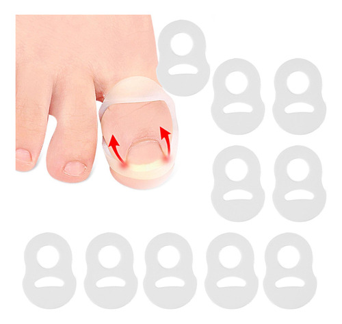 10 Uds. De Silicona Para Corregir Las Uñas Encarnadas,