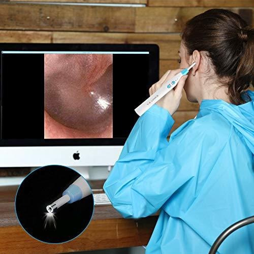 Camara Accesorio Digital Otoscope,valinks 2019 New