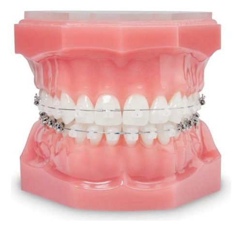 Brackets Damon Clear Con Arcos Y Tubos. 022 T. Standar