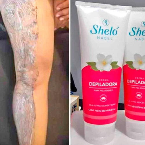 Imagen 4 de 10 de Crema Depiladora Shelo Original Grande Envío Express