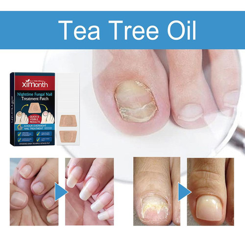 Adesivo Para Cuidados Com As Unhas 32 Peças