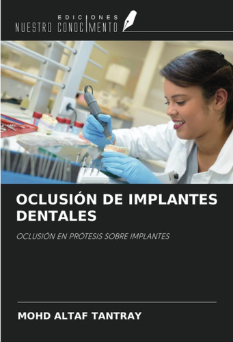 Libro: Oclusión De Implantes Dentales: Oclusión En Prótesis