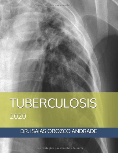 Libro: Tuberculosis: 2020 (spanish Edition)
