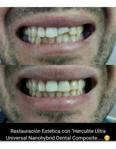 Imagen 6 de 10 de Consultorio Odontológico/ Dentista/ Prótesis Dentales