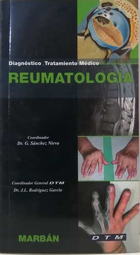 Reumatología Diagnostico Tratamiento Medico