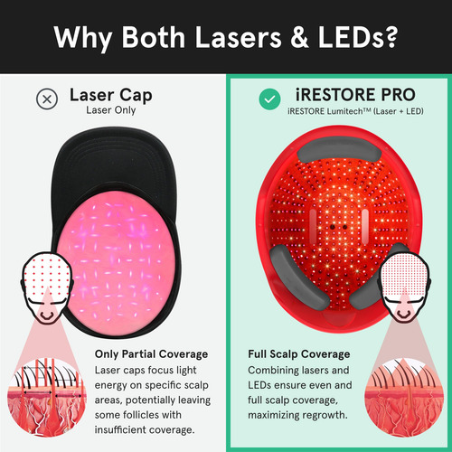 Sistema De Crescimento Capilar A Laser Irestore Professional