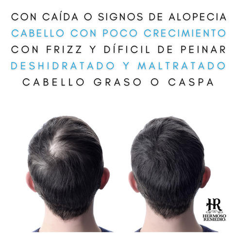 18 Shampoo Crecimiento Anticaída Caspa Reparador Hombre 7en1