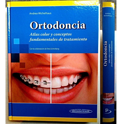 Ortodoncia Atlas Color Y Conceptos Fundamentales Tratamiento