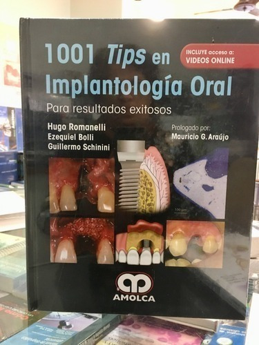 Libro - 1001 Tips En Implantología Oral Romanelli