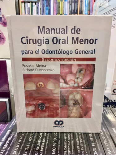 Manual De Cirugia Oral Menor Para El Odontólogo Gene, de PUSHKAR MEHRA. Editorial Amolca en español
