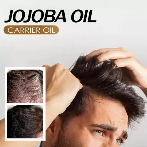 /aceite De Jojoba Orgánico, Prensado En Frío, Aceite Hidrata