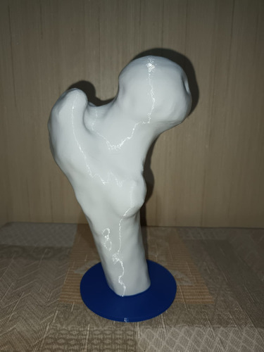 Anatomía Humana: Fémur Y Pelvis Femenina