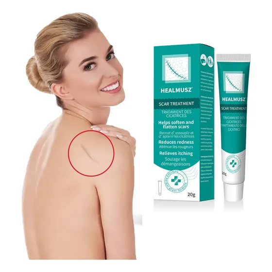 Crema Para Eliminar Cicatrices Para Cicatrices Físicas